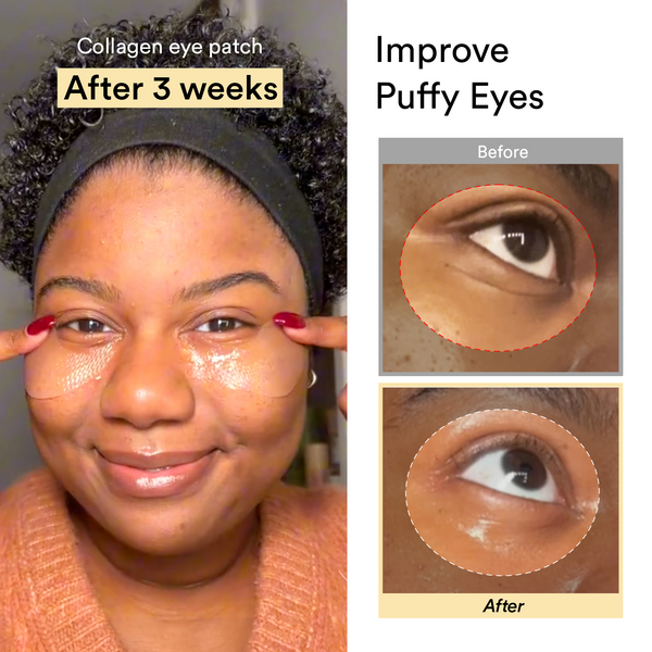 Amz no.1 collagen peptide eyepatch for anti-aging #1