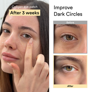 Amz no.1 collagen peptide eyepatch for anti-aging #1