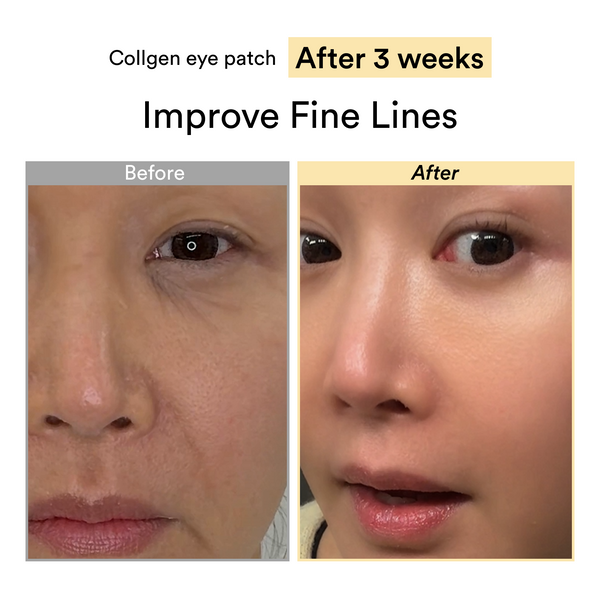 Amz no.1 collagen peptide eyepatch for anti-aging #1