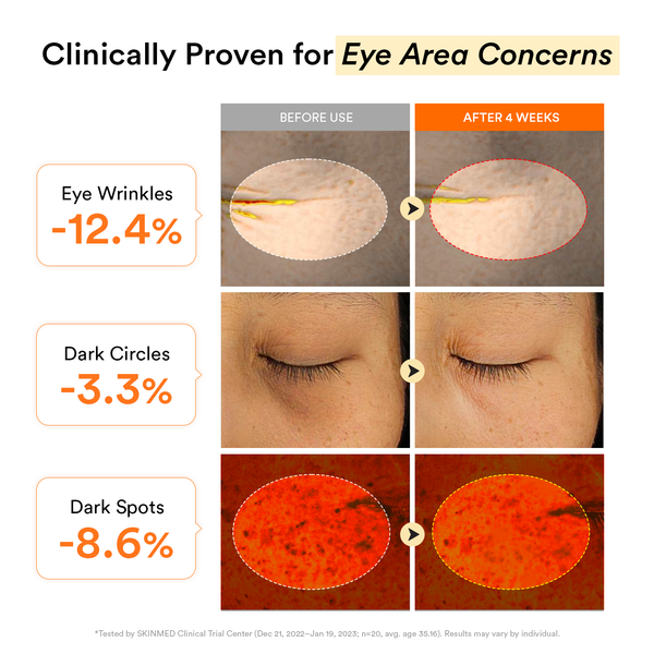 Amz no.1 collagen peptide eyepatch for anti-aging #1