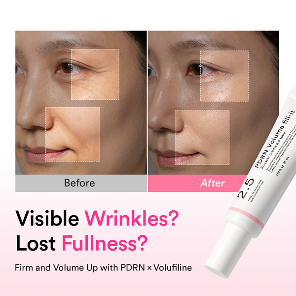 [NEW LAUNCH] Korea’s pharmacy best-seller PDRN & Volufiline wrinkle cream