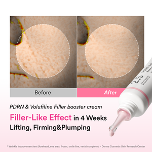 [NEW LAUNCH] Korea’s pharmacy best-seller PDRN & Volufiline wrinkle cream