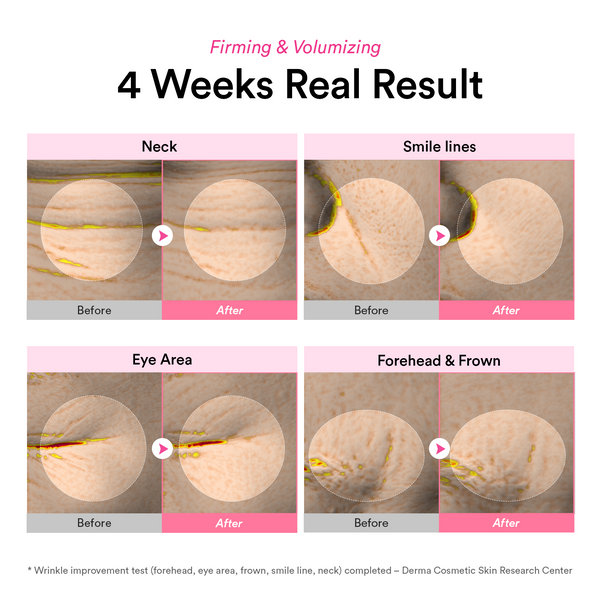 [NEW LAUNCH] Korea’s pharmacy best-seller PDRN & Volufiline wrinkle cream