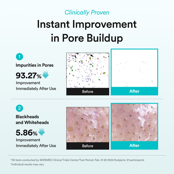 Green LHA pore pad Clear touch (Renewal)