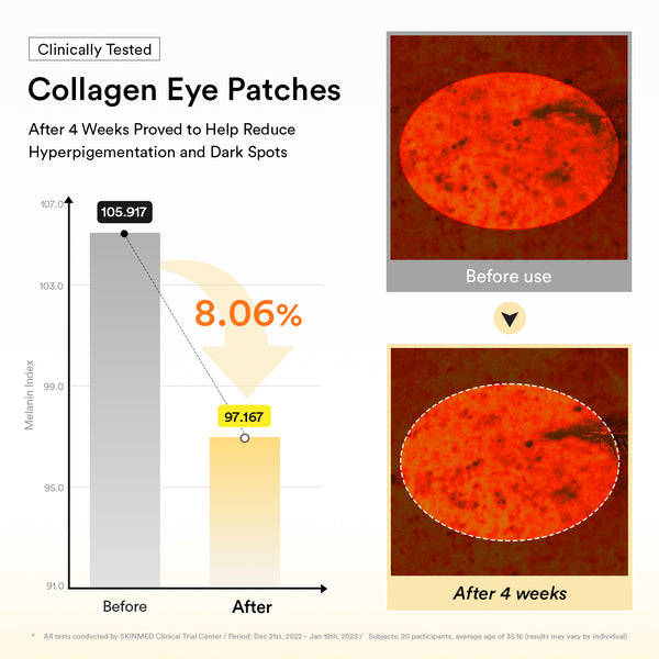 Eye-Deal Collagen Eye Care Kit