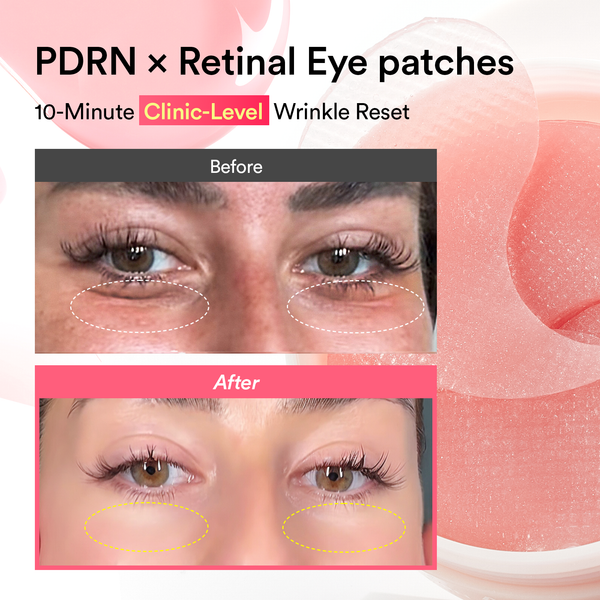PDRN x Retinal x Collagen Eye Patches for Wrinkle Repair & Anti-Aging Care